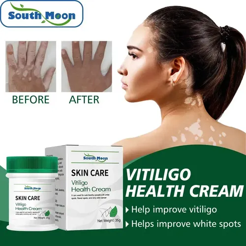 Cjw Tn 3 × Pomada Localizada Creme Vitiligo Branco M Para