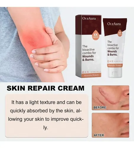 Hy./ La Crema Reparadora De Piel Oceaura Alivia El