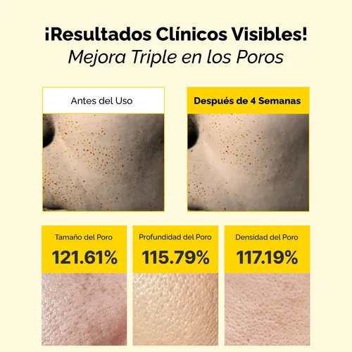 Crema Facial Retinol Mary&may Spicule Poros Arrugas