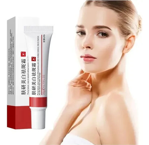 Crema Blanqueadora Con Niacinamida Que Elimina Las Manchas O