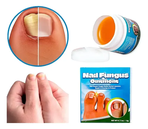 Crema Reparadora Uñas Antihongos Bálsamo Reparador