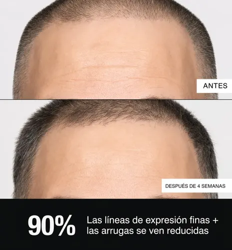 Exolift Potenciador Antiarrugas Reafirmante Mister Care Todo Tipo De Piel Día/noche