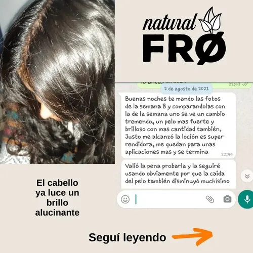 Loción Capilar Naturalfro Crecimiento Calvicie Caida X 400ml