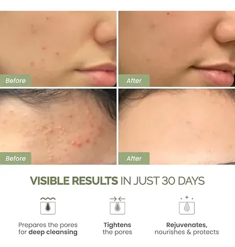 Plantifique Mascarilla Arcilla Coreana Limpieza Poros Kaolin