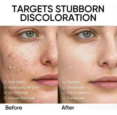 Crema Iluminadora Skintific Dark Spot 3.52 Oz