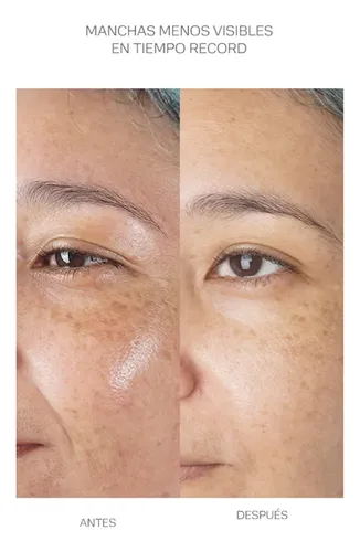 Bek Brightera Rejuvenation Clarifying Serum Facial