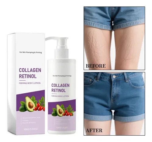 Loción Corporal Lol King, Hidratante Profunda, Áspera Y Seca