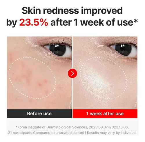 Crema Facial Antiedad Madeca Time Reverse 50 Ml Todo Tipo De Piel Día/noche