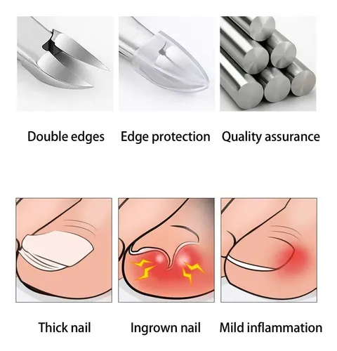 Alicate De Uñas,alicates De Corte De Alicates Para Cutículas