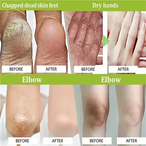 O Crema De Manos Antiarrugas Nutritiva
