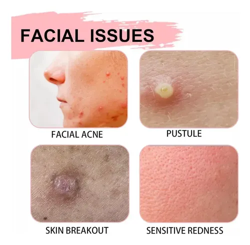 Af – Loción Facial For El Cuidado Del Rostro 30ml