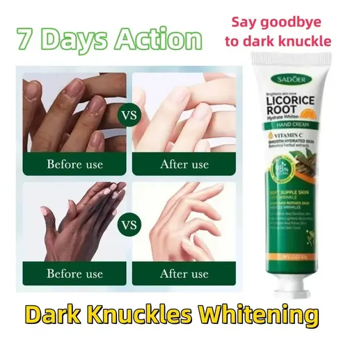 Crema Blanqueadora Y Abrillantadora Knuckles Fastx