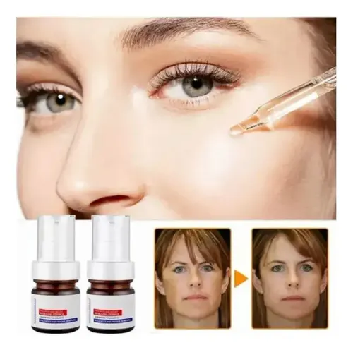 Whitening Y Freckle Eliminar La Esencia,aobenz