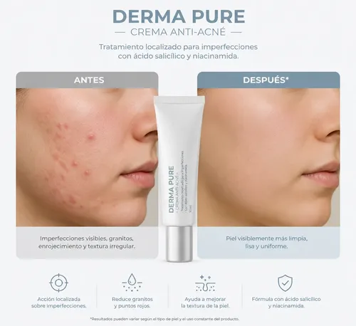 Crema Anti-acné Dermapure Ácido Salicílico Reduce Granitos