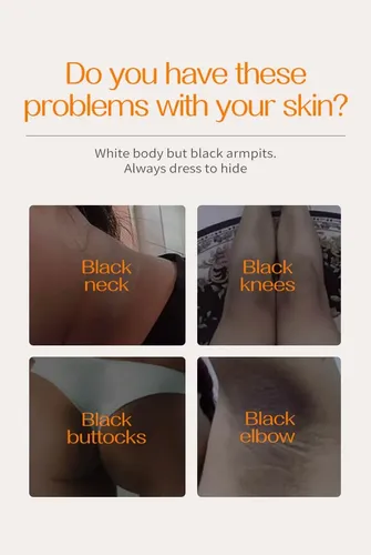 Crema Para Manchas Oscuras En La Cara, Crema Para Manchas Fa Todo Tipo De Piel Día/noche