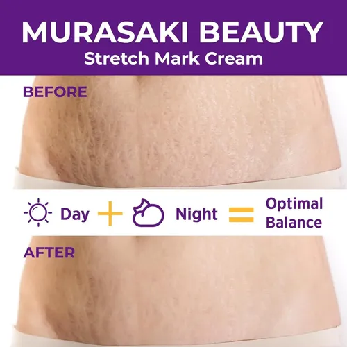 Crema Antiestrías Embarazo Murasaki 120g Nutre Y Previene