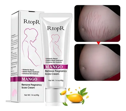 Crema Hidratante Para Estrías Y Cicatrices Yg Liankai 40g