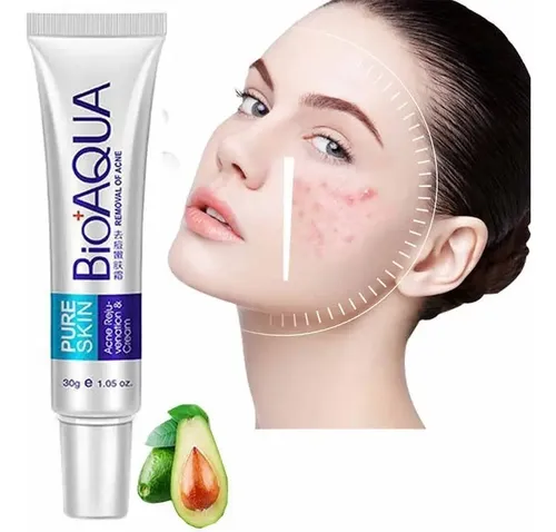 Gel Anti Acne Descongestivo Suavizante Poros Cerrados Lanben