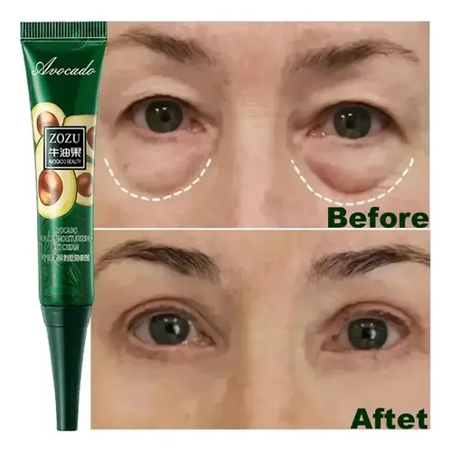Crema Antiarrugas Antiarrugas De 7 Días Para Ojos Oscuroser