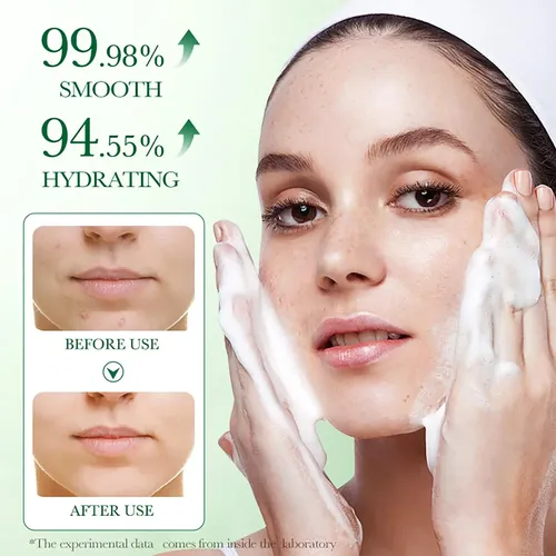 Gel Facial Espumoso Limpiador Centella Asiatica Anti Acne