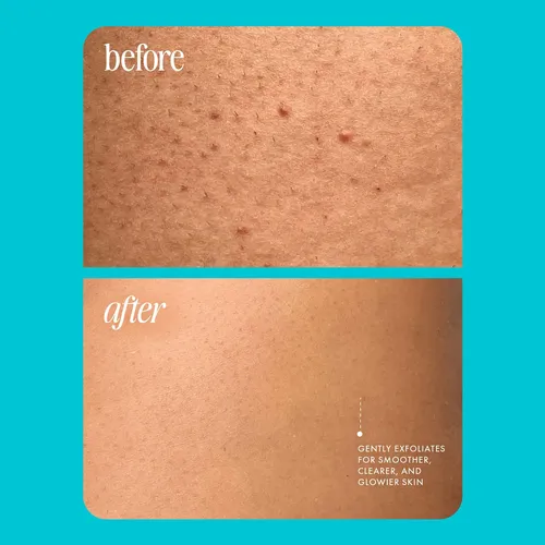 Gze Bikini Antes Del Área De Afeitado Exfoliante – Zcc