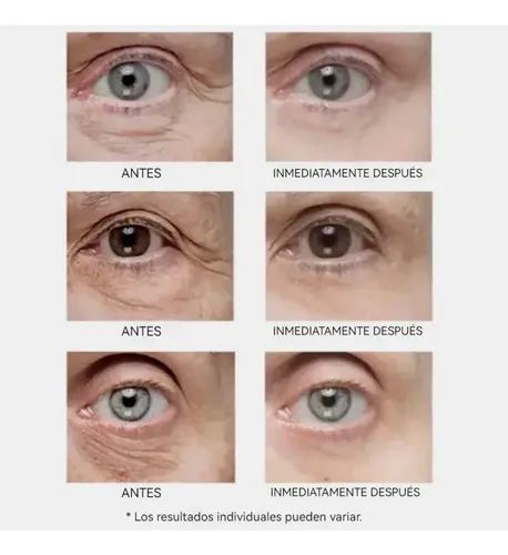 &y Crema Reafirmante Para Ojos 30 Ml 1 Unidad. Chicos #$