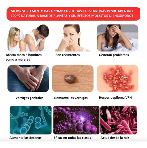 Verrugas Genitales Y Anales Nuevo Producto Muy Confiable