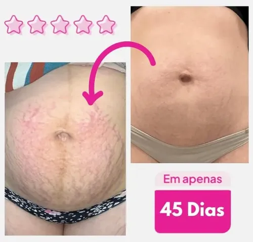 Crema Corporal Humectante Adeus No Grasosa 300 G Neutra