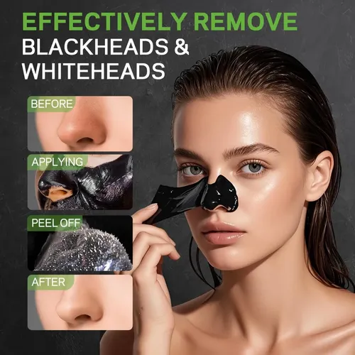 Mascarilla Removedora De Puntos Negros Hiisees 20g Todo Tipo De Piel