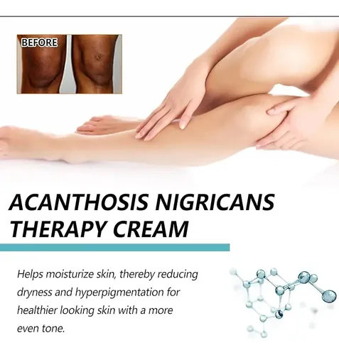 Crema Blanqueadora Para Zonas Íntimas