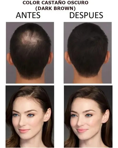 Fibras Capilares De Keratina 28gr Frasco Immetee Pelo Polvo