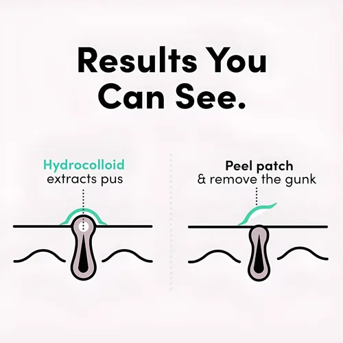 Acné Clear Patch Parches Para Acné 24 Unidades