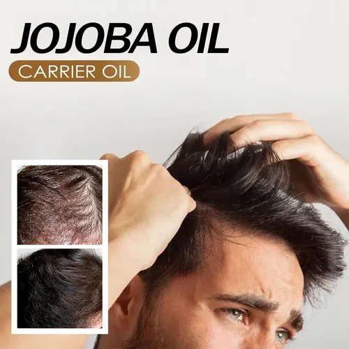 – Aceite De Jojoba Orgánico, Prensado En Frío, Aceite