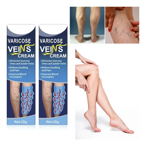 Pomada Varices Estrias Circulatoria Piernas Nutricion X2
