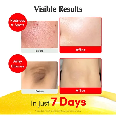 Serum Equal Berry Vitamina C Iluminador 30ml