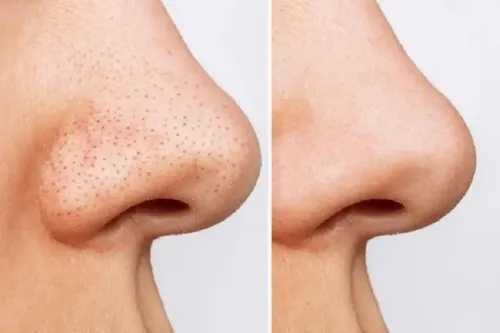 Combo Exfoliante Facial Y Corporal Biobellus 250 Gr