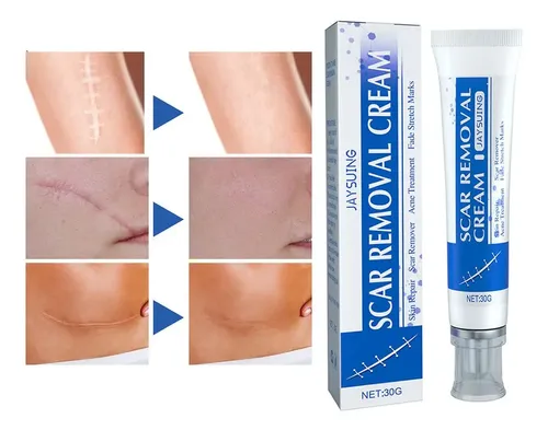 Crema De Eliminación De Cicatrizes%2c Fade Scars Crema R