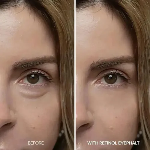 Dr.melaxin, Eyephalt, Retinol Eyebag Cream, 10 Gr
