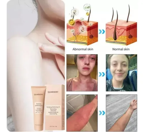 Gel Exfoliante Purificante Quarxery, Exfoliante Quarxery*1 U