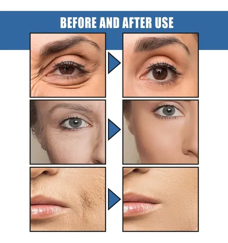 @ty.* 4×crema Antiarrugas Que Aclara Las Líneas Finas Y#