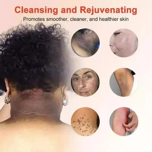 Quarxeri Purificante Exfoliante, Gel Exfoliante Avanzado Vs