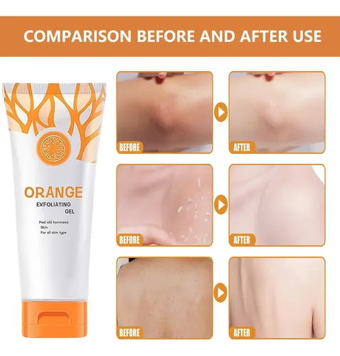 Gel Exfoliante De Naranja Para Rostro Y Cuerpo, Gel Exfolian