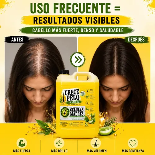 Shampoo Celulas Madre + Biotina Anti Caida + Crecimiento 5lt