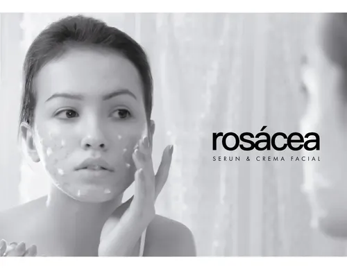 Sulderm Rosatopic Biosensitive Sulderm Pieles Sensibles Momento De Aplicación Día/noche Tipo De Piel Sensible