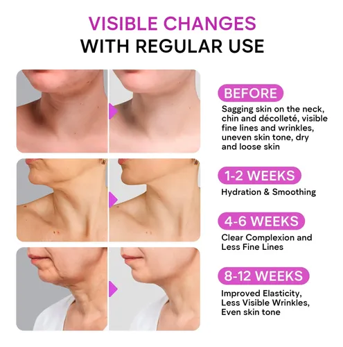 Crema Reafirmante Para El Cuello Remedial Paxwell Hidratante