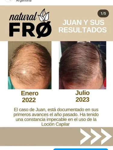 Loción Capilar Caida-crecimiento Capilar Naturalfro X 100ml