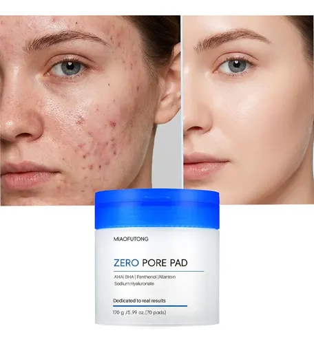 Pads Exfoliantes Ácido Salicílico Cuidado Poros 70 Todo Tipo De Piel Día/noche
