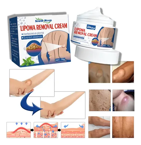 Una Crema Para Eliminar Lipomas, Crema Limpiadora De
