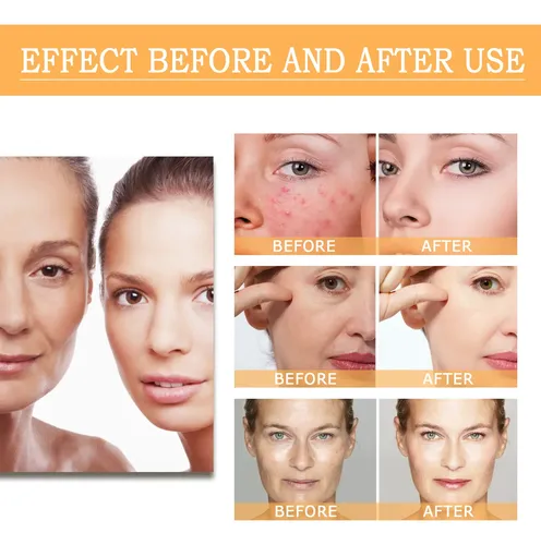 -d/ Tónico Exfoliante Original Con Ácido Glicólico Al 7 ,]