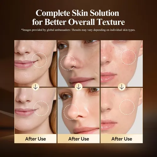 Masajeador Facial Eléctrico Anlan Gua Sha Luz Roja Blanco